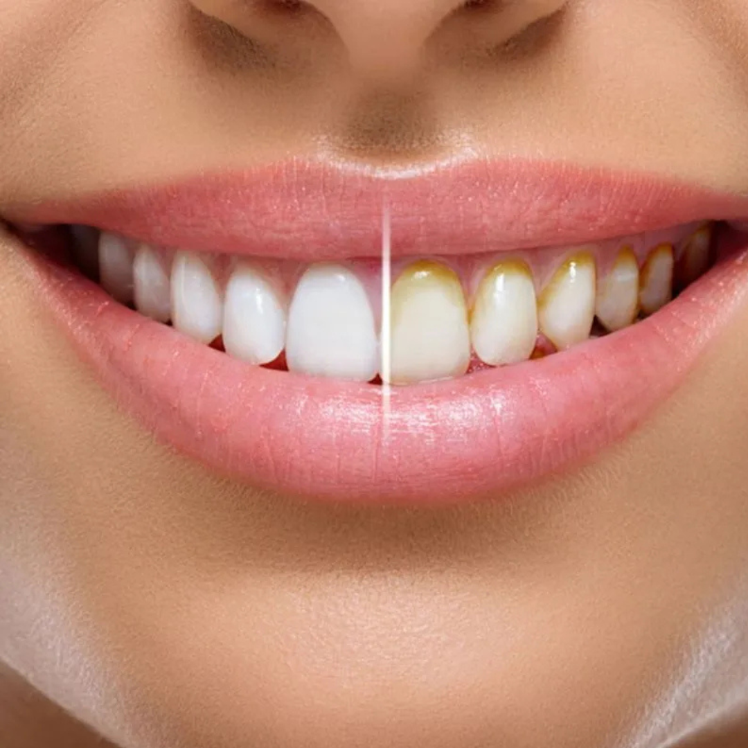 Recambios Miracle Smile - Packs de Cabezales Reemplazables